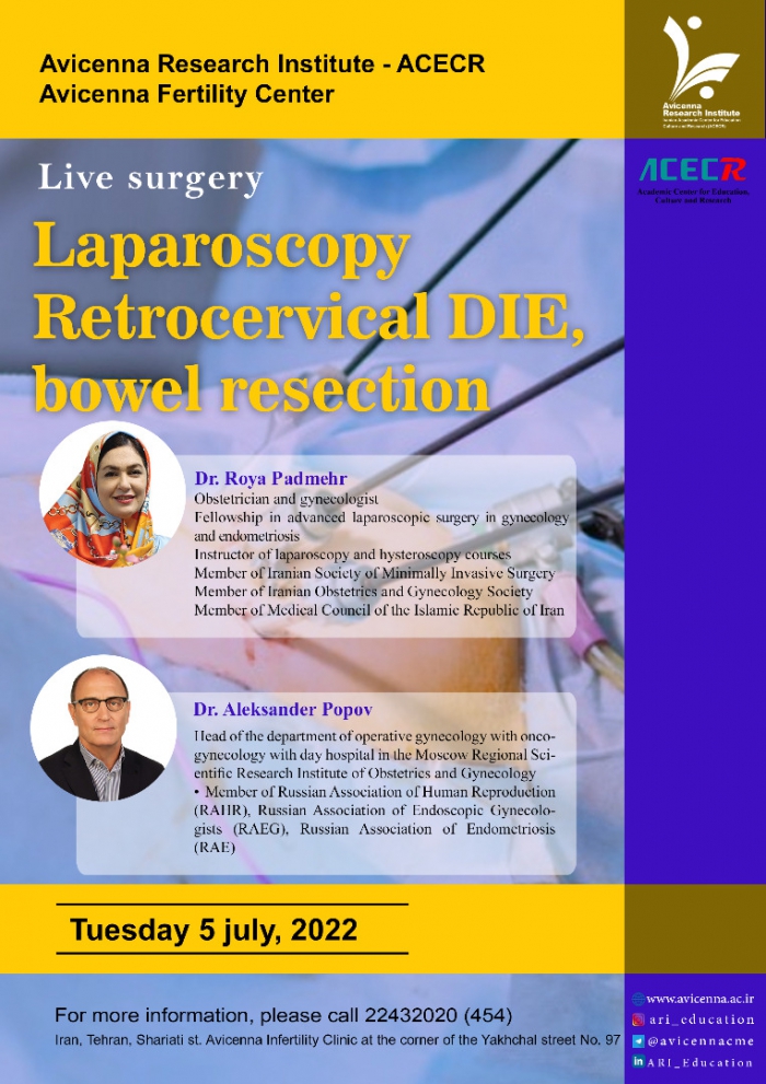 Live Surgery &quot;Laparoscopy Retrocervical DIE, bowel resection&quot;