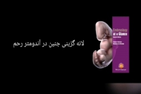 لانه گزینی جنین در اندومتر رحم
